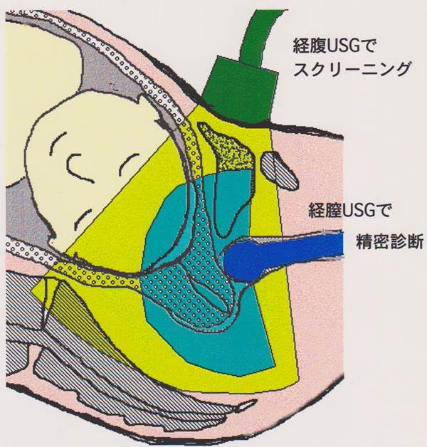 頚 管 さ 子宮 長 妊婦検診で子宮頚管はいつ頃から測るものなんでしょうか?それともお腹の張りなどがない限りは測…